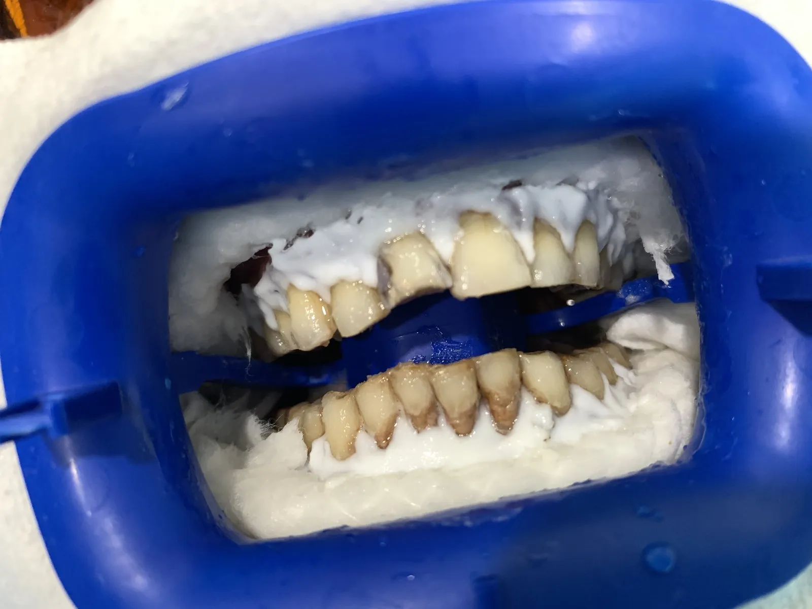 The gums protected during in-clinic whitening